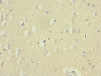 UBE2F Antibody