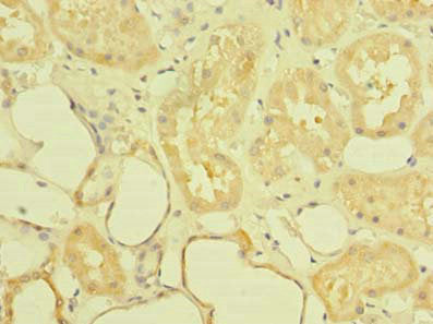 ST6GALNAC6 Antibody