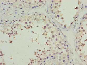 PPP1R14A Antibody