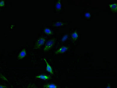 TMEM159 Antibody