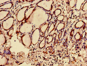 C12orf43 Antibody