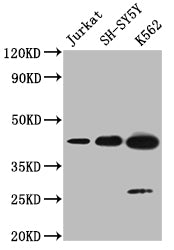 NSUN4 Antibody