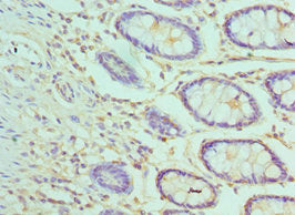 AP2M1 Antibody
