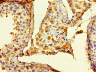 ALG14 Antibody