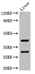 TIMD4 Antibody