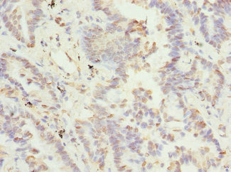 TSSK3 Antibody