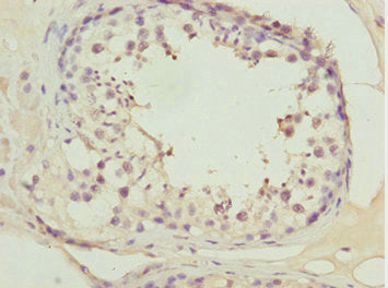 ATOH7 Antibody
