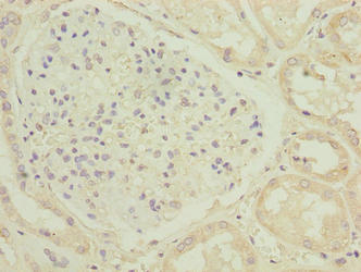 C17orf47 Antibody