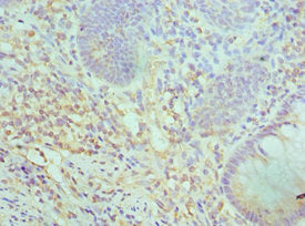 SMARCC2 Antibody