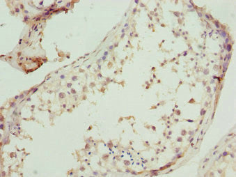 UBA3 Antibody