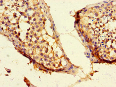 CEP192 Antibody