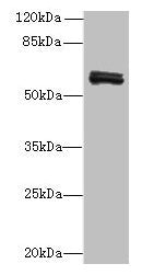 FAM222B Antibody