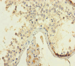 HMGB4 Antibody