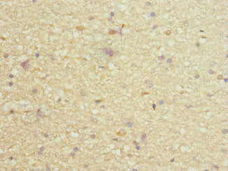 PIEZO1 Antibody