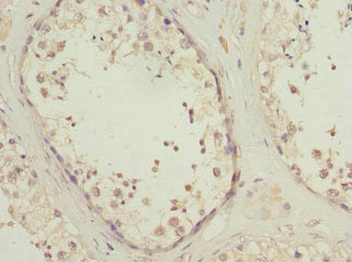 PIK3R3 Antibody