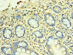 TFG Antibody