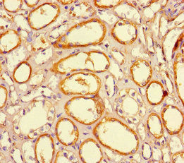 JARID2 Antibody
