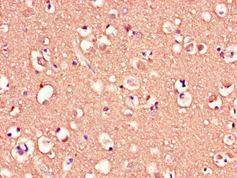 MED12 Antibody
