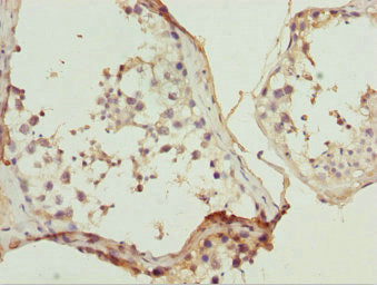 ULK4 Antibody
