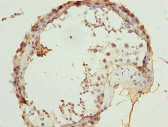 ULK4 Antibody