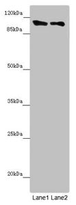 DDX11 Antibody