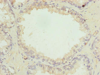 ACSBG1 Antibody