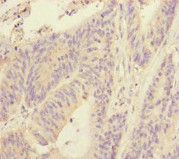 RBM17 Antibody