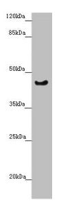 RBM17 Antibody