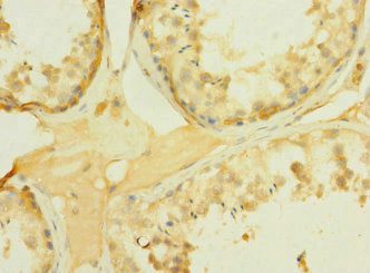 PCDH15 Antibody