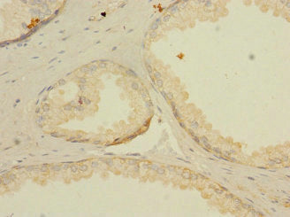 LNX2 Antibody