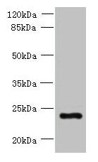 PQLC3 Antibody
