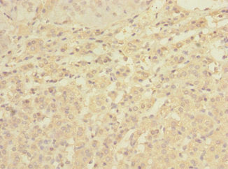 C1orf127 Antibody