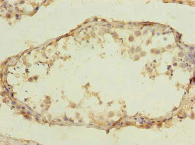 CLEC4C Antibody