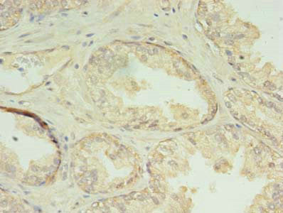 CHMP7 Antibody