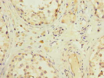 ZFPM2 Antibody