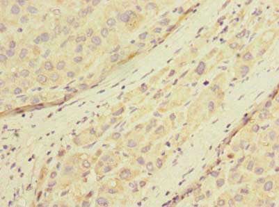 POMGNT1 Antibody