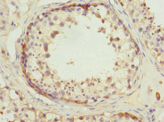 RDH5 Antibody