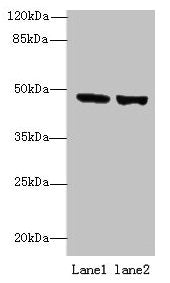 TENT5B Antibody