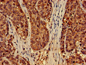 EFHD2 Antibody