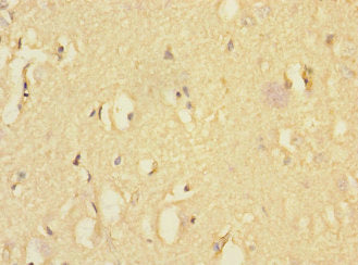 EAF2 Antibody