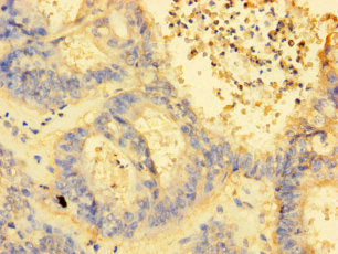 MRPL38 Antibody