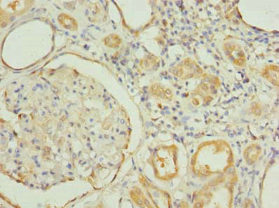 RNF31 Antibody