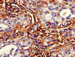 VMP1 Antibody