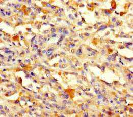 VPS50 Antibody