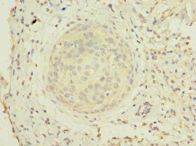 ZHX1-C8orf76 Antibody