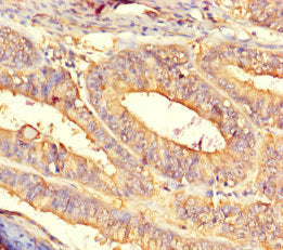 CNDP2 Antibody