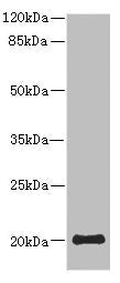 PPP3R2 Antibody