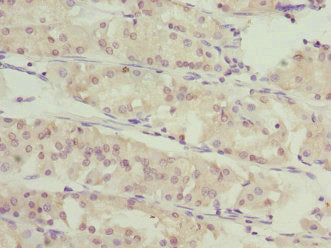 SLC46A1 Antibody