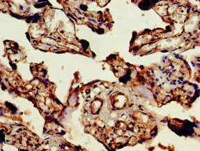 ARAP1 Antibody