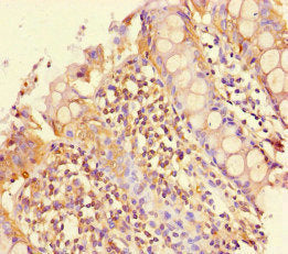 PEBP4 Antibody